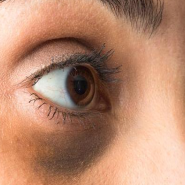 Anti Dark Circle/Anti Dark Spots