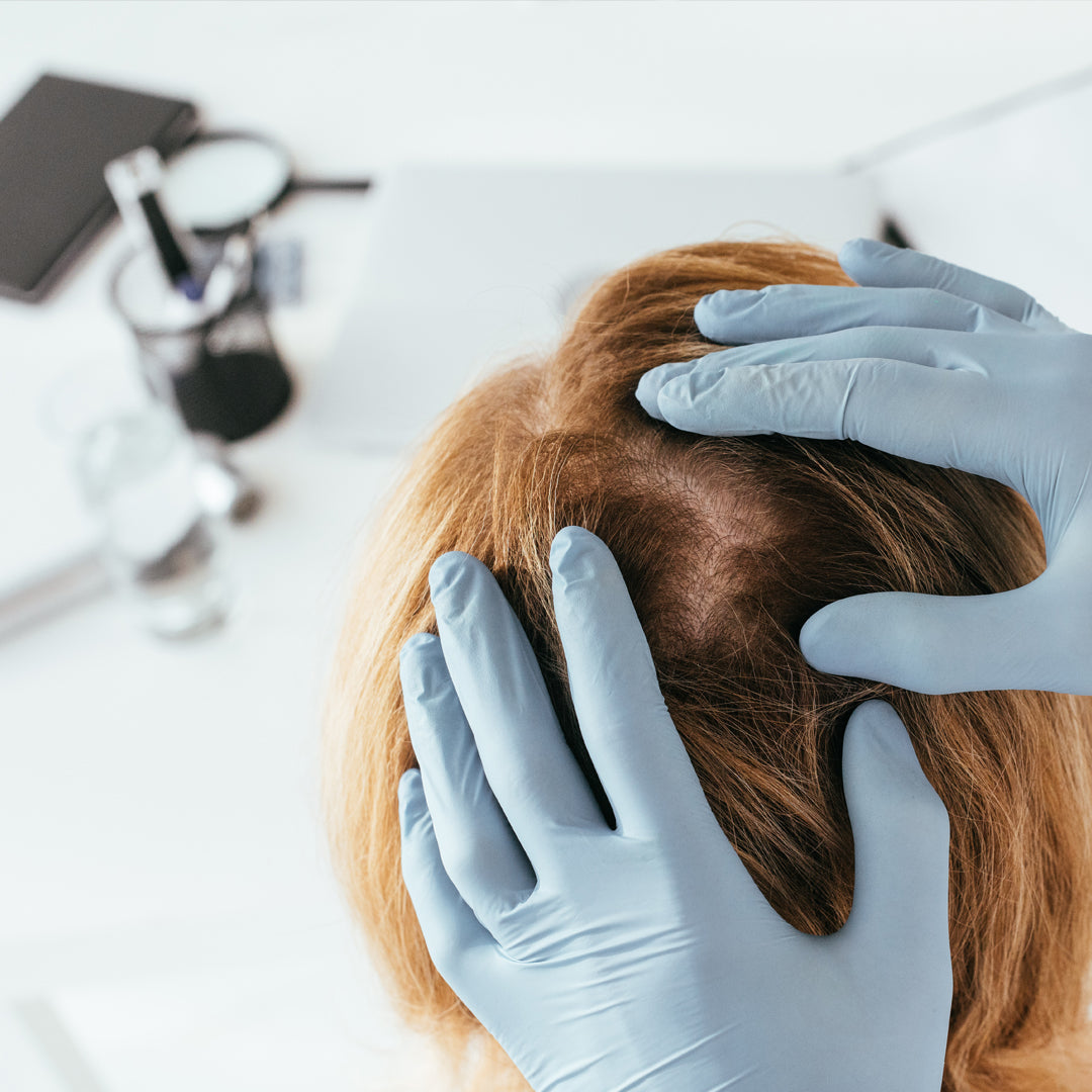 Regular Clinical Trial-for hair growth and hair fall