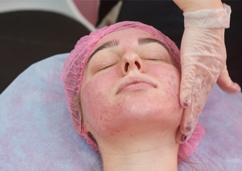Skin Sensitization